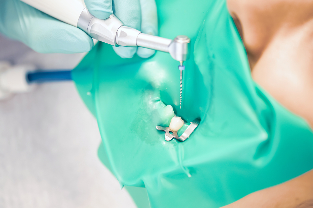 Orthodontic treatment at Dr. Bruce Edward King Dental Practice