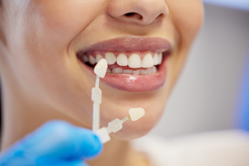 Cosmetic dentistry services at Dr. Bruce Edward King Dental Practice